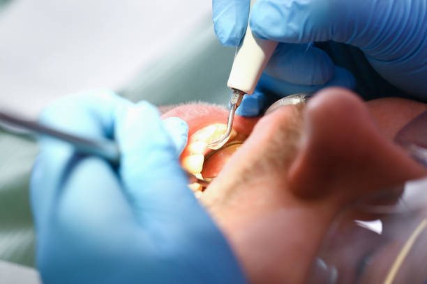 Best Emergency Tooth Extraction  in Prieton, NC